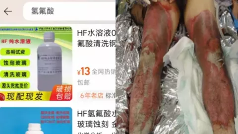 氢氟酸中毒