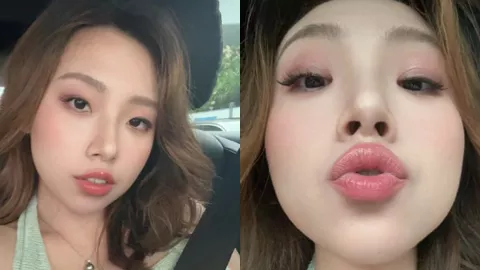 詹慧珺