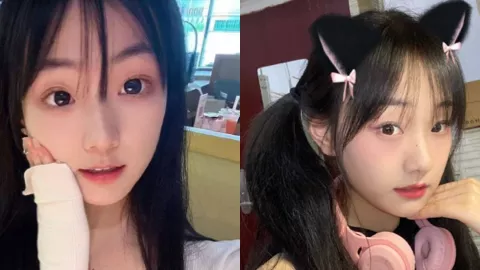 张佳薇