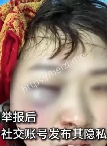 举报