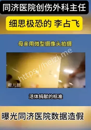 诱捐器官