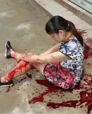 精神病患者