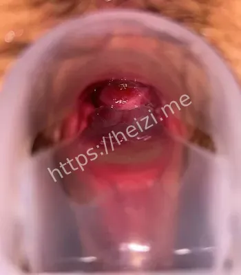 网络暴力