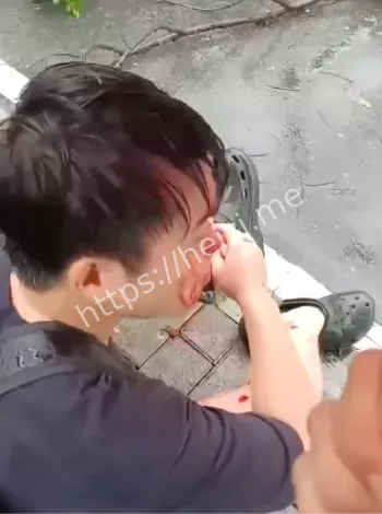 赔偿争议