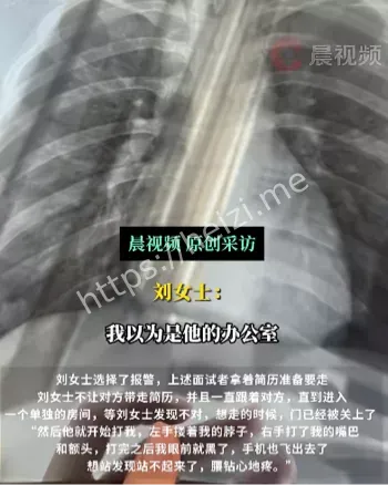 26岁女子
