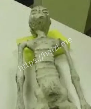 CT扫描研究