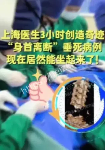 身首离断患者
