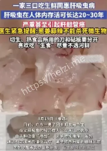 肝吸虫病