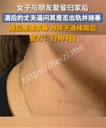 家庭暴力