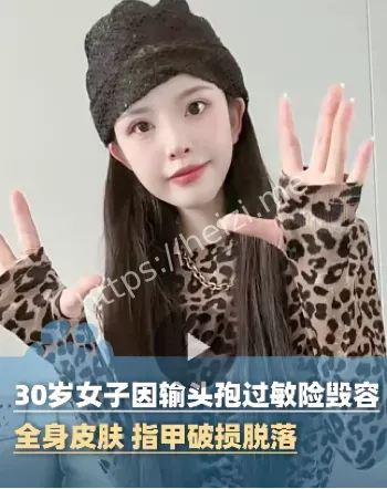 输头孢过敏