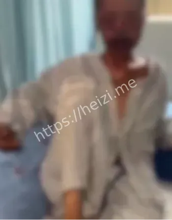 皮肤溃烂脱落
