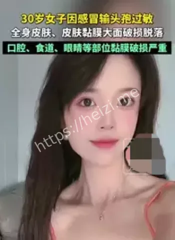 头孢皮试争议