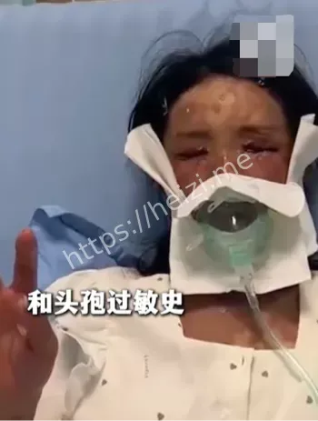 皮肤溃烂脱落