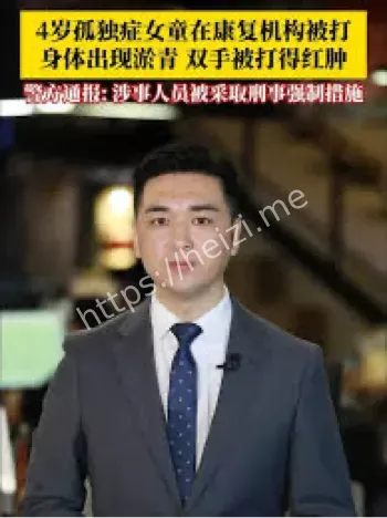 孤独症儿童