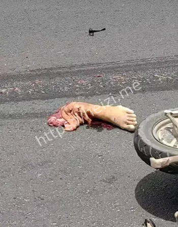 当场死亡