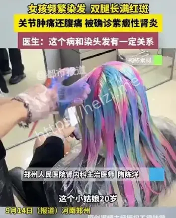 00后追星染发
