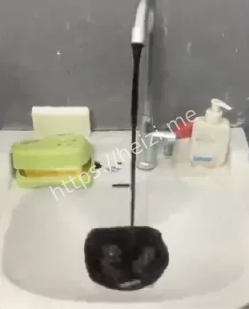 食源性中毒