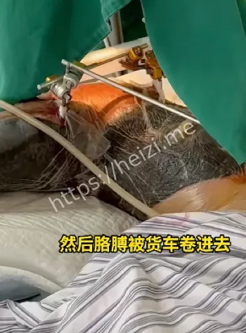 半挂货车挤压