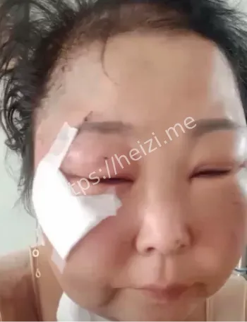 张某铭刑拘